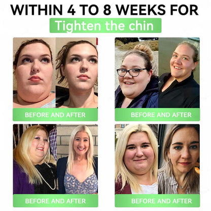 🧬Alcuras™ Moringa × Berberine × AMPK 8-Benefit Slimming & Metabolic Nano Microneedle Patch❤️